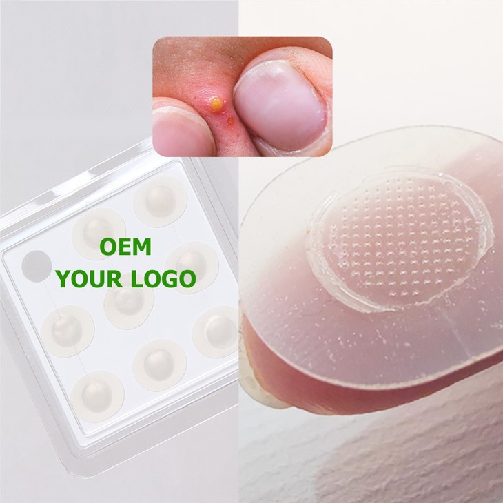 hydrocolloid patches